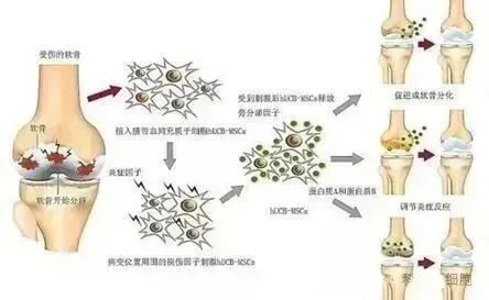 关节腔注射干细胞后,关节软骨持续再生!干细胞让骨关节炎康复成为可能 640 (1).jpg