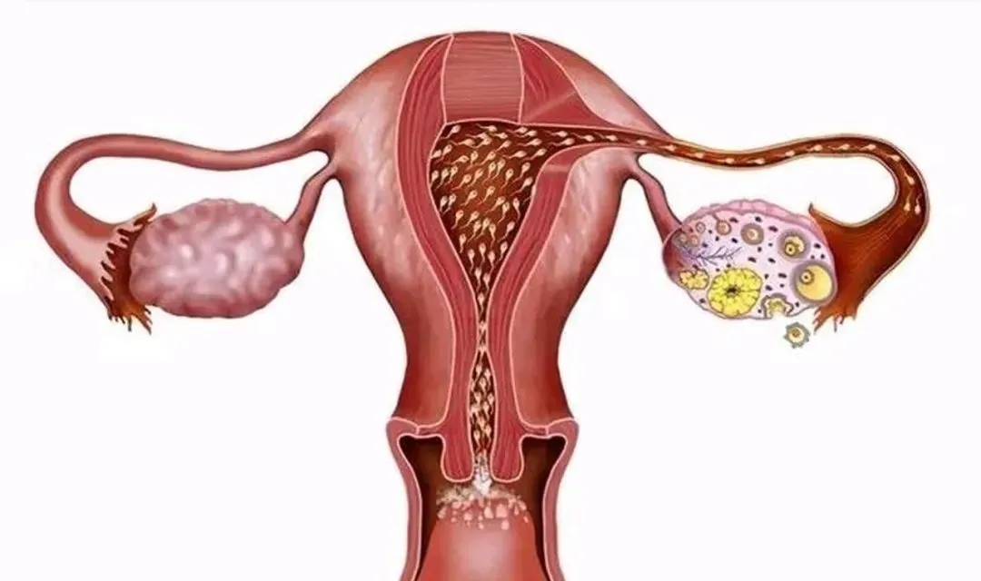 间充质干细胞改善卵巢早衰61例，挽救卵巢功能并成功怀孕